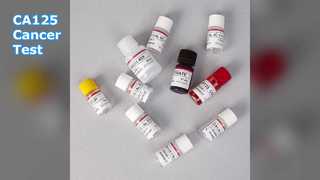Xét nghiệm ELISA CA125 để theo dõi ung thư