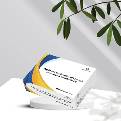 Chlamydiapneumoniae ((Cpn) - kháng thể IgM Cassette Colloidal gold rapid test reagent