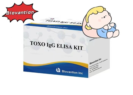 Đèn đuốc độ nhạy cao TOXO IgG ELISA Test Kit Thử nghiệm bệnh viện Kiểm tra mang thai