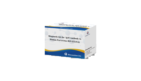 Bộ chẩn đoán cho parvovirus B19 IgG ELISA thử nghiệm bộ kháng thể cho mẫu huyết thanh
