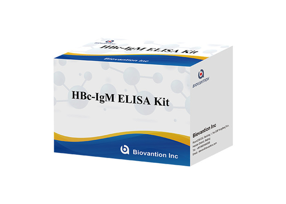 ISO13485 Bộ xét nghiệm HBc IgM Xét nghiệm Igm kháng thể lõi kháng viêm gan B