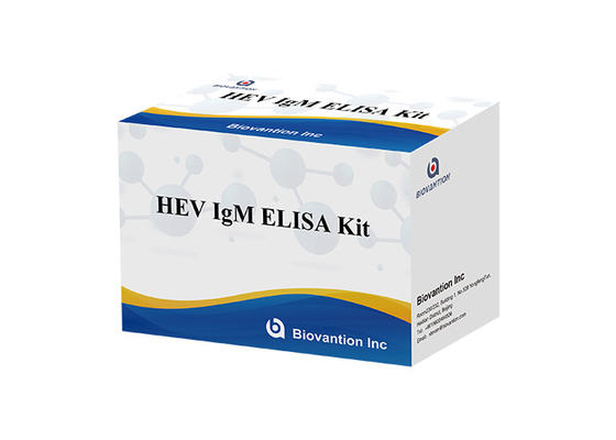 Bộ xét nghiệm HEV IgM Elisa Huyết thanh Vs Huyết tương để phát hiện kháng thể