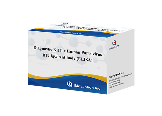 Bộ chẩn đoán cho parvovirus B19 IgG ELISA thử nghiệm bộ kháng thể cho mẫu huyết thanh