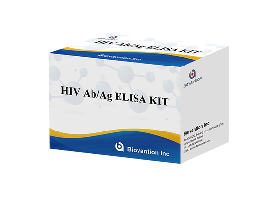 ISO13485 Xét nghiệm HIV Ab Ag Hiv Xét nghiệm thế hệ thứ 4 Bộ ELISA 60 phút