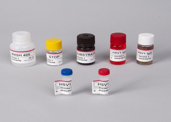 Bộ thử nghiệm ELISA kháng thể / kháng nguyên của virus suy giảm miễn dịch ở người (HIV)
