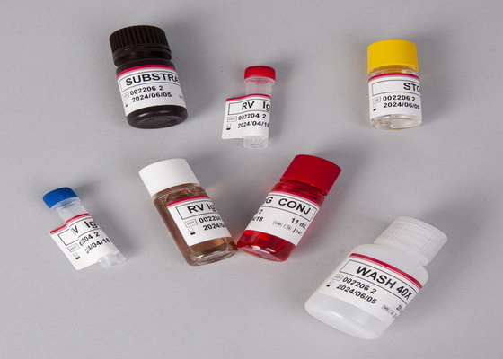 Bộ thử nghiệm Alpha Fetoprotein AFP Elisa cho phòng thí nghiệm hoặc bệnh viện