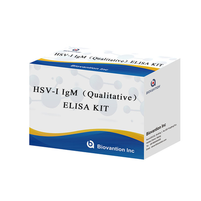 Phòng thí nghiệm hoặc Bệnh viện Hướng dẫn chính xác cao để sử dụng HSV I IgG ELISA Test KIT
