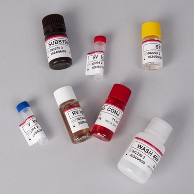 Bộ thử nghiệm RV-G Elisa để chẩn đoán loại mẫu plasma