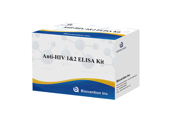 Bộ thử nghiệm Elisa HIV Thời hạn sử dụng 18 tháng Thử nghiệm Elisa với độ nhạy và đặc tính cao