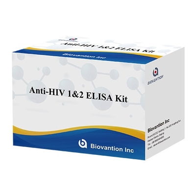 Bộ thử nghiệm Elisa HIV Thời hạn sử dụng 18 tháng Thử nghiệm Elisa với độ nhạy và đặc tính cao