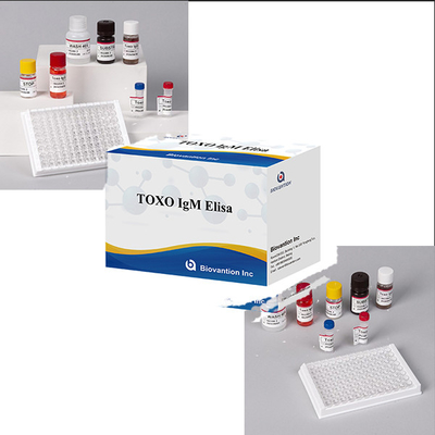 Bệnh viện phòng thí nghiệm phòng khám sử dụng Toxo IgM ELISA TEST KIT chính xác cao