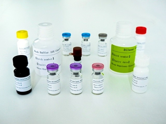 Mycobacterium Tuberculosis Thiết bị xét nghiệm Elisa