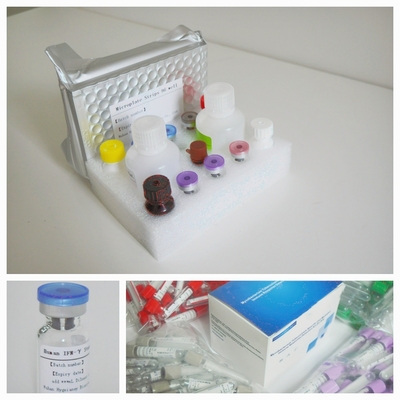 Mycobacterium Tuberculosis Thiết bị xét nghiệm Elisa
