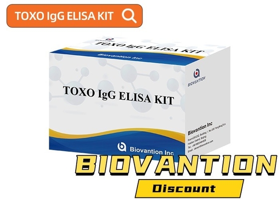 TOXO Ig G Bộ thử nghiệm Elisa nhạy cảm và cụ thể để theo dõi bệnh