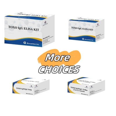 TOXO Ig G Bộ thử nghiệm Elisa nhạy cảm và cụ thể để theo dõi bệnh