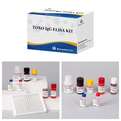 TOXO Ig G Bộ thử nghiệm Elisa nhạy cảm và cụ thể để theo dõi bệnh