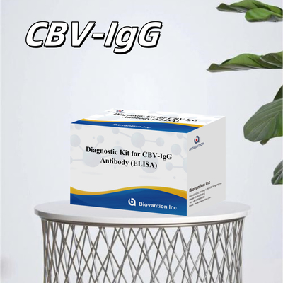 Bộ chẩn đoán nhạy cảm cho CBV-IgG Kháng thể con người phát hiện Bộ Elisa để phát hiện loại mẫu chính xác