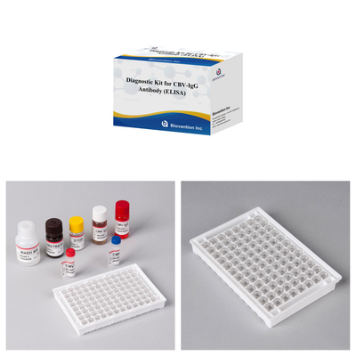 Bộ chẩn đoán nhạy cảm cho CBV-IgG Kháng thể con người phát hiện Bộ Elisa để phát hiện loại mẫu chính xác