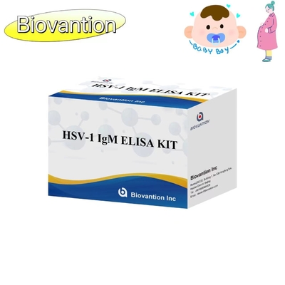 Bộ thử nghiệm ELISA đèn đuốc HSV 1 IgM High Hot Sale Diagnostic Reagent IVD
