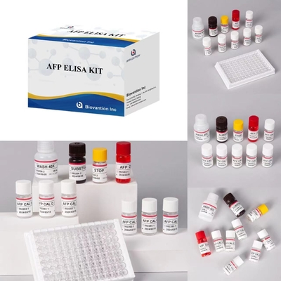AFP Alpha Fetoprotein Elisa Test Kit Các sản phẩm liên quan đến enzyme Thời gian vận chuyển ngắn