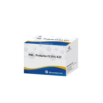 PRL Số lượng Hormone con người Phương pháp chẩn đoán