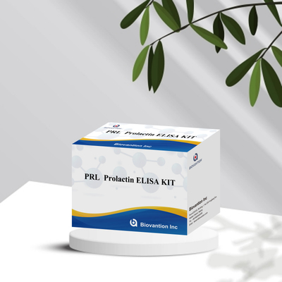 PRL Số lượng Hormone con người Phương pháp chẩn đoán