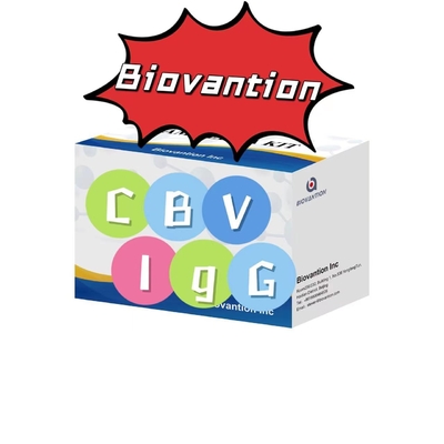 Bộ chẩn đoán cho kháng thể CBV-IgG Bộ thử nghiệm ELISA Bộ thử nghiệm huyết thanh