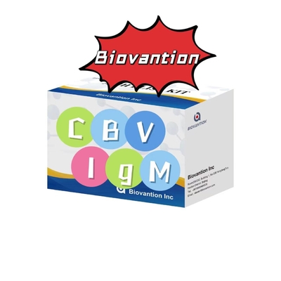 Bộ chẩn đoán cho kháng thể IgM chống lại CBV Elisa Test Kit 50μL Serum Chẩn đoán y tế