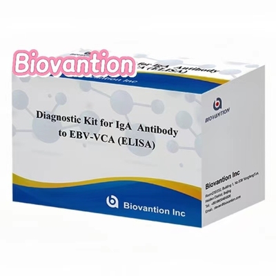 Bộ ELISA EBV VCA IgA nhạy cao để chẩn đoán y tế bằng cách sử dụng mẫu huyết thanh 50μl
