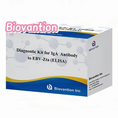 Bộ chẩn đoán cho kháng thể IgA đối với EBV-Zta ELISA TEST KIT Bộ thử nghiệm immunosorbent Assay