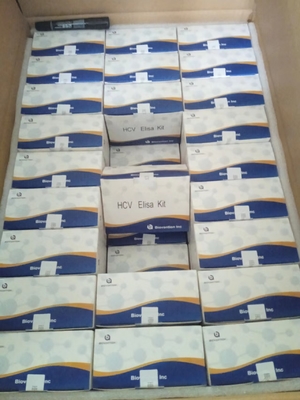 Bộ thử nghiệm HCV ELISA: Hồ sơ không có phản ứng chéo để thử nghiệm chính xác