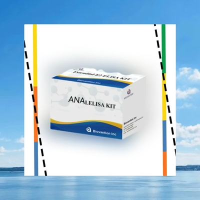 Thiết bị thử nghiệm ELISA chống ANA IgG Thiết bị phát hiện chất lượng kháng thể IgG hạt nhân