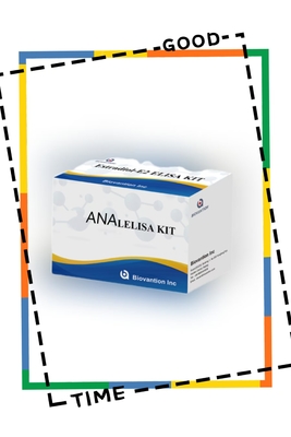 Thiết bị thử nghiệm ELISA chống ANA IgG Thiết bị phát hiện chất lượng kháng thể IgG hạt nhân