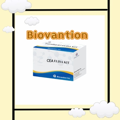 Thiết bị thử nghiệm CEA ELISA kháng nguyên ung thư phôi liên kết với enzym trong huyết thanh người