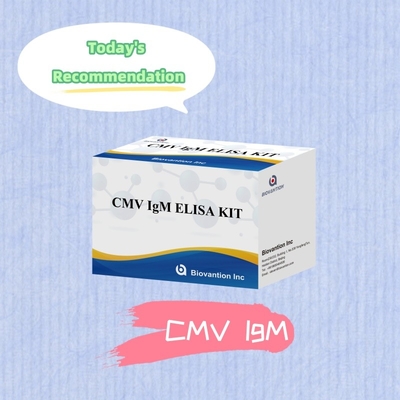 Kiểm tra ELISA chất lượng IgM của đại thực bào Bộ thí nghiệm IVD Nhạy cảm cao
