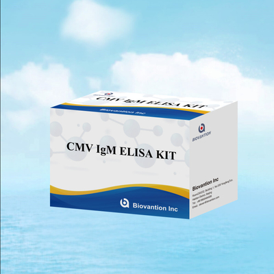 Kiểm tra ELISA chất lượng IgM của đại thực bào Bộ thí nghiệm IVD Nhạy cảm cao