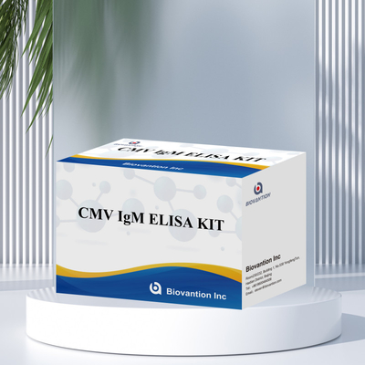 Kiểm tra ELISA chất lượng IgM của đại thực bào Bộ thí nghiệm IVD Nhạy cảm cao