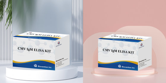 Kiểm tra ELISA chất lượng IgM của đại thực bào Bộ thí nghiệm IVD Nhạy cảm cao