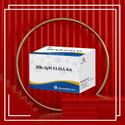 Xét nghiệm chất phản ứng chẩn đoán HBc IgM chính xác cao với bộ thử nghiệm hấp thụ miễn dịch liên kết với enzyme