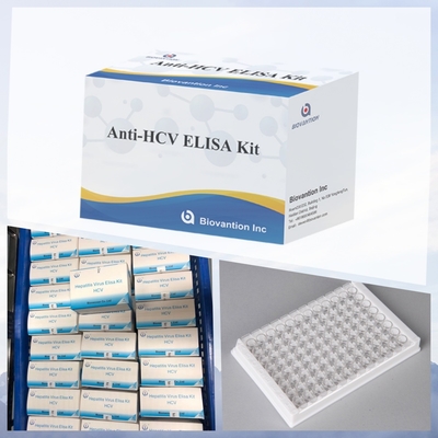 Kiểm tra chất phản ứng IVD mới cho bệnh nhân HCV