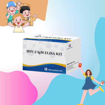 Bộ thử nghiệm Elisa đặc tính cao HSV-2 IgM cho kết quả nhanh và chính xác