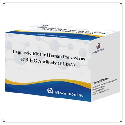 Bộ dụng cụ chẩn đoán sử dụng ở người cho parvovirus B19 IgM kháng thể Elisa Test Kit với 96T