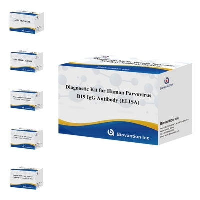 Bộ dụng cụ chẩn đoán sử dụng ở người cho parvovirus B19 IgM kháng thể Elisa Test Kit với 96T