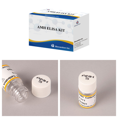 Bộ thử nghiệm Elisa AMH tiên tiến để phát hiện và đo chính xác và phân tích
