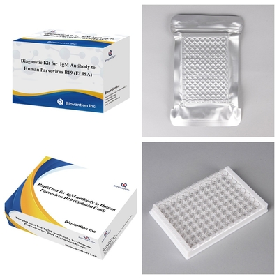 Bộ chẩn đoán cho kháng thể IgM parvovirus B19 của con người ELISA lý tưởng cho Erythema Infectiosum và biến chứng trong thai kỳ
