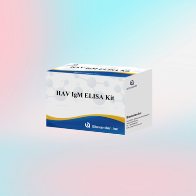 HAV IgM ELISA Kit Độ nhạy cao Viêm gan A Khám phá virus Kiểm tra chẩn đoán chính xác đáng tin cậy cho các phòng thí nghiệm lâm sàng