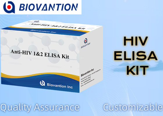 Bộ thử nghiệm ELISA1/2 chống HIV tiên tiến cho phân tích nhạy cảm và cụ thể của các rối loạn thần kinh
