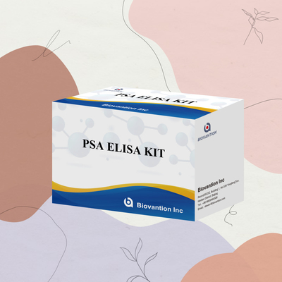 Bộ thử nghiệm kháng nguyên cụ thể tuyến tiền liệt PSA chính xác để phát hiện các dấu hiệu sinh học nhạy cảm và cụ thể trong các mẫu