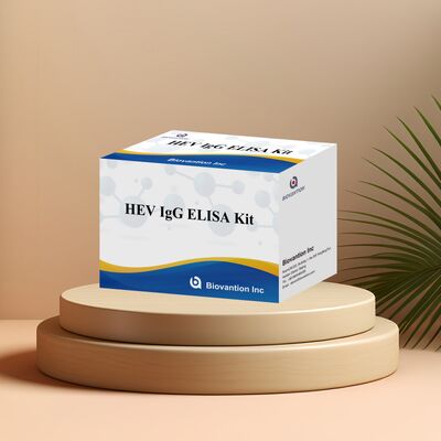 Bộ thử nghiệm ELISA HEV-IgG nhạy cao với kích thước 96T và thời hạn sử dụng 18 tháng để chẩn đoán viêm gan E