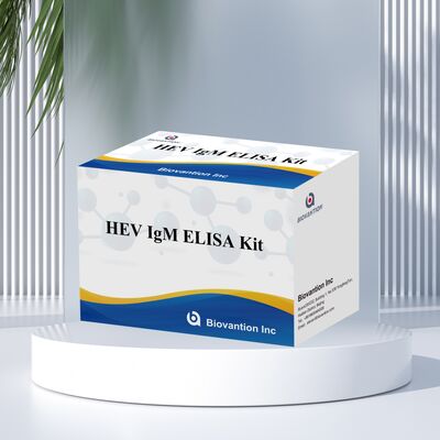 Bộ thử nghiệm Elisa HEV IgM độ nhạy cao với kích thước 96T và thời gian xét nghiệm 2-3 giờ để chẩn đoán chính xác